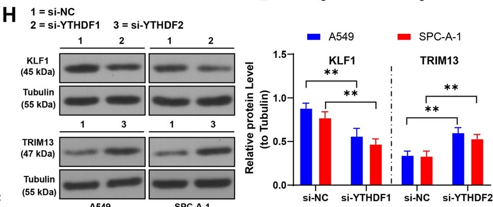 Fig.4.H showing Western Blotting from the publication: RBM15-dependent m6A modification mediates progression of non-small cell lung cancer cells.