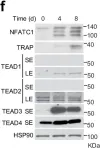 Fig.6.F showing Western Blotting in a Homo sapiens (Human) sample from the publication: Long noncoding RNA Malat1 protects against osteoporosis and bone metastasis.