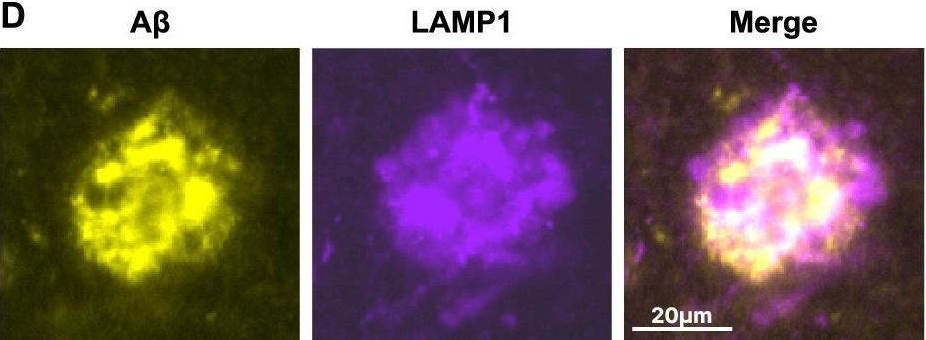 Fig.4.D showing Immunocytochemistry-immunofluorescence in a Mus musculus (House mouse) sample from the publication: Isotope-encoded spatial biology identifies plaque-age-dependent maturation and synaptic loss in an Alzheimer's disease mouse model.