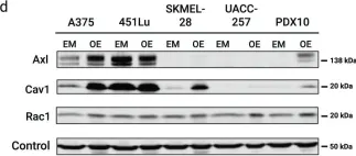 Fig.3.D showing Western Blotting from the publication: SRC-RAC1 signaling drives drug resistance to BRAF inhibition in de-differentiated cutaneous melanomas.