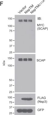 Fig.5.F showing Western Blotting in a Homo sapiens (Human) sample from the publication: SARS-CoV-2 papain-like protease plays multiple roles in regulating cellular proteins in the endoplasmic reticulum.