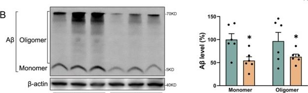 Fig.2.B showing Western Blotting in a Mus musculus (House mouse) sample from the publication: AS1842856 Reduces β-Amyloid Burden via Inhibiting PLA2G4A-Mediated Lysosomal Dysfunction in APP/PS1 Mice.