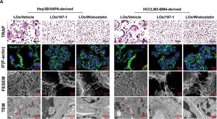 Fig.8.A showing Immunocytochemistry-immunofluorescence from the publication: Large Oncosome-Loaded VAPA Promotes Bone-Tropic Metastasis of Hepatocellular Carcinoma Via Formation of Osteoclastic Pre-Metastatic Niche.