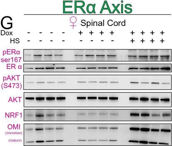 Fig.2.G showing Western Blotting from the publication: Doxycycline promotes proteasome fitness in the central nervous system.