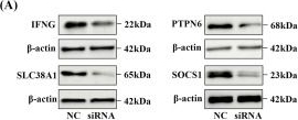 Fig.7.A showing Western Blotting in a Homo sapiens (Human) sample from the publication: Integrating cuproptosis- and ferroptosis-related gene signatures to predict prognosis, immunotherapy response, and drug sensitivity in patients with skin cutaneous melanoma.