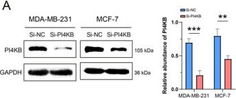 Fig.8.A showing Western Blotting in a Homo sapiens (Human) sample from the publication: Paraptosis-related genes regulate tumor immune microenvironment and predict prognosis in breast cancer.