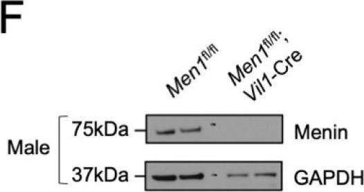 Fig.5.F showing Western Blotting in a Mus musculus (House mouse) sample from the publication: Menin Maintains Cholesterol Content in Colorectal Cancer via Repression of LXR-Mediated Transcription.