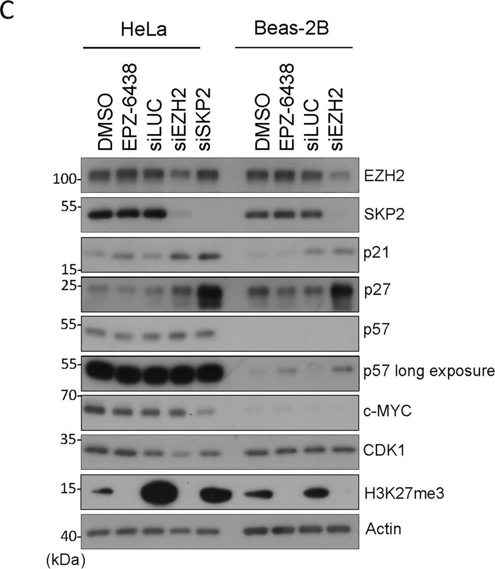Fig.2.C showing Western Blotting from the publication: Enzyme-independent role of EZH2 in regulating cell cycle progression via the SKP2-KIP/CIP pathway.