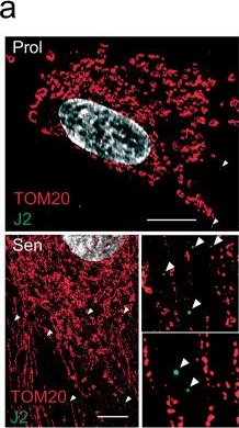 Fig.1.A showing Immunohistochemistry-immunofluorescence from the publication: Mitochondrial RNA cytosolic leakage drives the SASP.