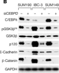 Fig.2.B showing Western Blotting from the publication: Stabilization of E-cadherin adhesions by COX-2/GSK3β signaling is a targetable pathway in metastatic breast cancer.