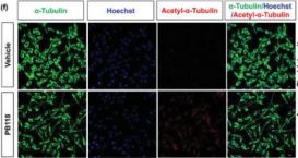 Acetyl-α-Tubulin (Lys40) (D20G3) XP® Rabbit mAb | Cell