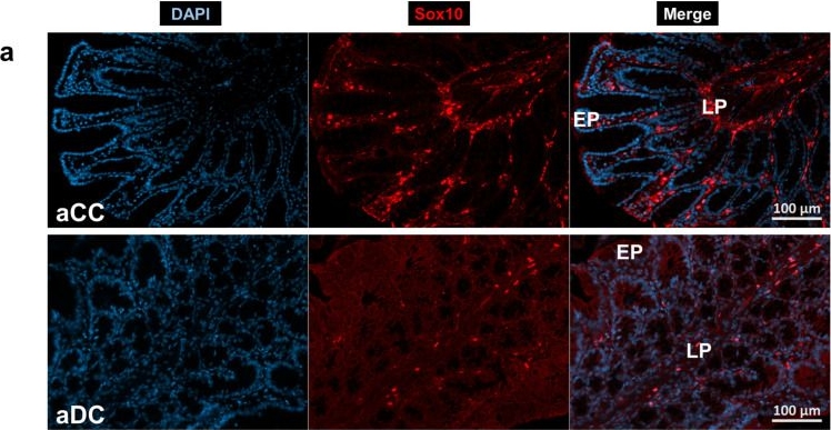 Fig.7.A showing Immunohistochemistry-immunofluorescence in a Rattus norvegicus (Rat) sample from the publication: Enteric Glial Network in Diabetes: Quantitative Changes of Glial Density in Rats in Response to Acute and Chronic Hyperglycaemia.