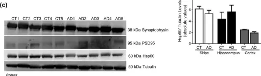 Fig.10.C showing Western Blotting from the publication: Differential protein expression in diverse brain areas of Parkinson's and Alzheimer's disease patients.