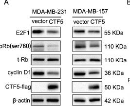 Fig.6.A showing Western Blotting from the publication: MCPIP1-mediated NFIC alternative splicing inhibits proliferation of triple-negative breast cancer via cyclin D1-Rb-E2F1 axis.