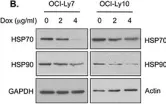 Fig.5.B showing Western Blotting in a Homo sapiens (Human) sample from the publication: Inhibition of COP9-signalosome (CSN) deneddylating activity and tumor growth of diffuse large B-cell lymphomas by doxycycline.