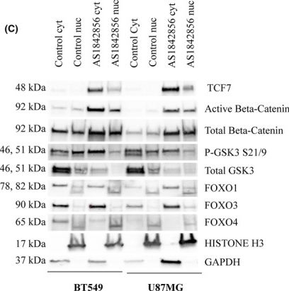 Fig.3.C showing Western Blotting from the publication: FOXO1 promotes the expression of canonical WNT target genes in examined basal-like breast and glioblastoma multiforme cancer cells.