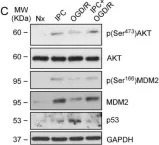 Fig.1.C showing Western Blotting from the publication: Preconditioning-Activated AKT Controls Neuronal Tolerance to Ischemia through the MDM2-p53 Pathway.