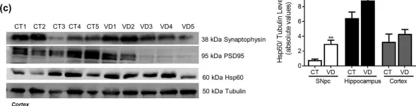 Fig.15.C showing Western Blotting from the publication: Differential protein expression in diverse brain areas of Parkinson's and Alzheimer's disease patients.