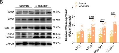 Fig.6.B showing Western Blotting from the publication: TMEM251 loss-induced autophagy dysfunction in the anterior cingulate cortex contributes to chronic postoperative pain.