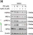Fig.6.H showing Western Blotting from the publication: Functional Suppression of SCAP Triggers Endoplasmic Reticulum Stress-Dependent Ferroptosis by Impairing Cholesterol Metabolism in Gastric Cancer.
