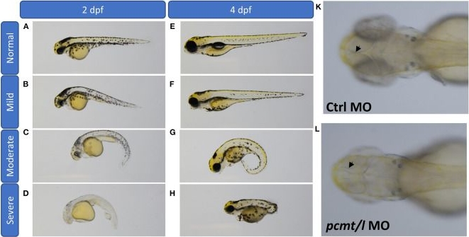 Fig.5.A showing Immunohistochemistry from the publication: l-Isoaspartyl Methyltransferase Deficiency in Zebrafish Leads to Impaired Calcium Signaling in the Brain.