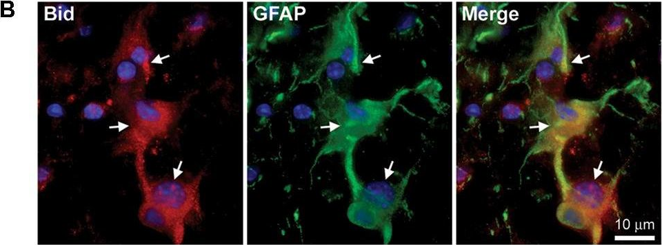 Fig.2.B showing Immunohistochemistry in a Mus musculus (House mouse) sample from the publication: The Bcl-2 Homology-3 Domain (BH3)-Only Proteins, Bid, DP5/Hrk, and BNip3L, Are Upregulated in Reactive Astrocytes of End-Stage Mutant SOD1 Mouse Spinal Cord.