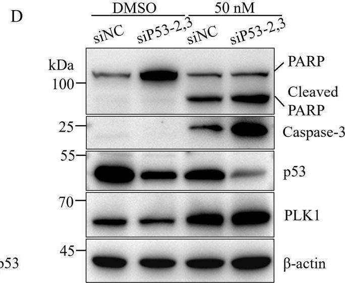 Fig.3.D showing Western Blotting in a Homo sapiens (Human) sample from the publication: The status of p53 affects the efficacy of PLK1 inhibitor BI6727 in prostate cancer cells.