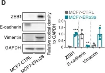 Fig.1.D showing Western Blotting in a Homo sapiens (Human) sample from the publication: The essential role of YAP in ERα36-mediated proliferation and the epithelial-mesenchymal transition in MCF-7 breast cancer cells.