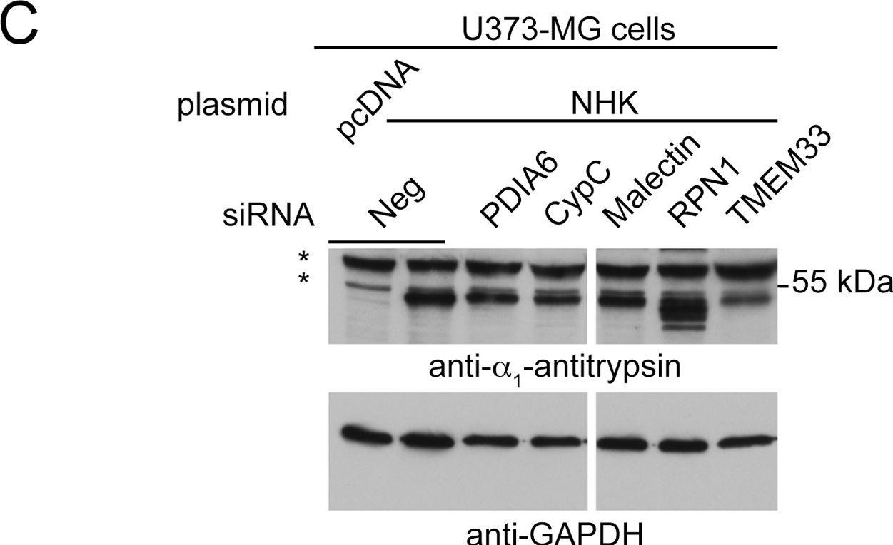 Fig.7.C showing Western Blotting in a Homo sapiens (Human) sample from the publication: Cyclophilin C Participates in the US2-Mediated Degradation of Major Histocompatibility Complex Class I Molecules.