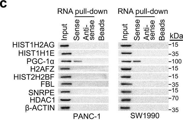 Fig.4.C showing Western Blotting in a Homo sapiens (Human) sample from the publication: LINC00842 inactivates transcription co-regulator PGC-1α to promote pancreatic cancer malignancy through metabolic remodelling.