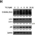 Fig.1.H showing Western Blotting in a Homo sapiens (Human) sample from the publication: Blockage of O-linked GlcNAcylation induces AMPK-dependent autophagy in bladder cancer cells.