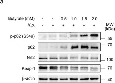 Fig.4.A showing Western Blotting from the publication: Butyrate protects against Klebsiella pneumoniae-induced oxidative stress in alveolar macrophages via p62-Keap1-Nrf2 pathway.