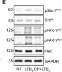 Fig.4.E showing Western Blotting from the publication: Intestinal epithelial BLT1 promotes mucosal repair.