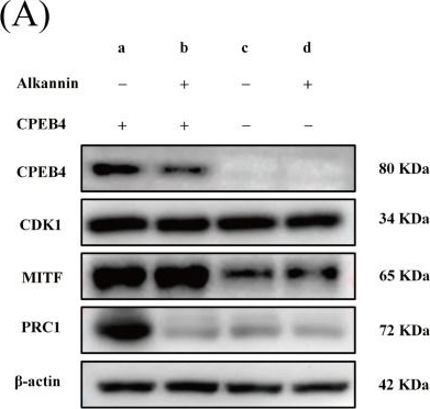 Fig.7.A showing Western Blotting from the publication: Interaction of Alkannin with CPEB4 Contributes to Its Antitumor Effects in Melanoma.