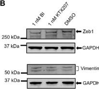 Fig.5.B showing Western Blotting in a Homo sapiens (Human) sample from the publication: KTX207-mediated PDE4D degradation disrupts tumour cell migration, invasion, and angiogenic potential.