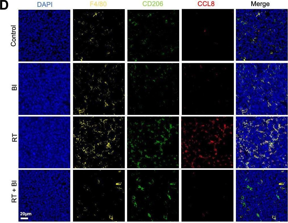 Fig.6.D showing Immunocytochemistry-immunofluorescence in a Mus musculus (House mouse) sample from the publication: Single-cell RNA sequencing reveals recruitment of the M2-like CCL8high macrophages in Lewis lung carcinoma-bearing mice following hypofractionated radiotherapy.