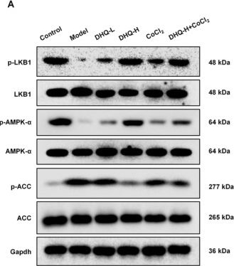 Fig.5.A showing Western Blotting from the publication: Molecular Mechanism of Dihydroquercetin in Ameliorating Metabolic Dysfunction-Associated Steatotic Liver Disease: Insights Into the HIF-1α/VEGF Pathway.