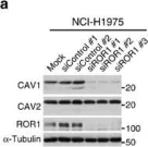 Fig.2.A showing Western Blotting in a Homo sapiens (Human) sample from the publication: ROR1 sustains caveolae and survival signalling as a scaffold of cavin-1 and caveolin-1.