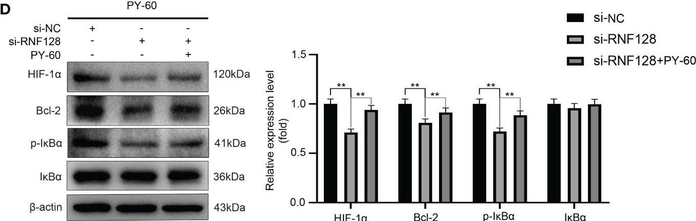 Fig.5.D showing Western Blotting from the publication: Ring finger protein 128 promotes, rather than inhibits, colorectal cancer progression by regulating the Hippo signaling pathway.