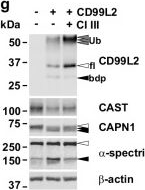 Fig.5.G showing Western Blotting in a Homo sapiens (Human) sample from the publication: Loss-of-function variants in the CAPN1 activator CD99L2 cause X-linked spastic ataxia.