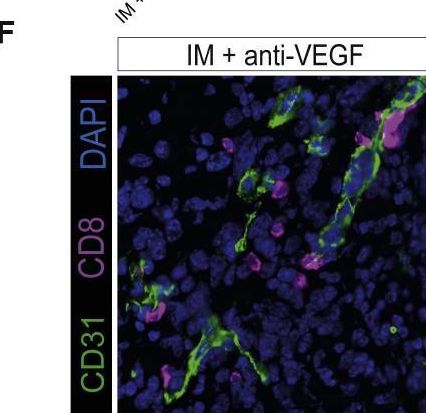 Fig.3.F showing Immunohistochemistry-immunofluorescence in a Mus musculus (House mouse) sample from the publication: Cancer cell autophagy, reprogrammed macrophages, and remodeled vasculature in glioblastoma triggers tumor immunity.