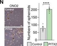 Fig.3.N showing Immunohistochemistry from the publication: Aberrant Hippo-YAP/TEAD Signaling Drives Malignant Transcriptional Reprogramming in External Auditory Canal Squamous Cell Carcinoma.