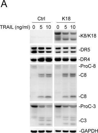 Fig.3.A showing Western Blotting in a Homo sapiens (Human) sample from the publication: Cytokeratin 8/18 protects breast cancer cell lines from TRAIL-induced apoptosis.