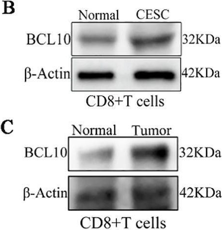 Fig.6.B showing Western Blotting in a Mus musculus (House mouse) sample from the publication: High-expression of BCL10 inhibits cell-mediated immunity within the tumor immune microenvironment.