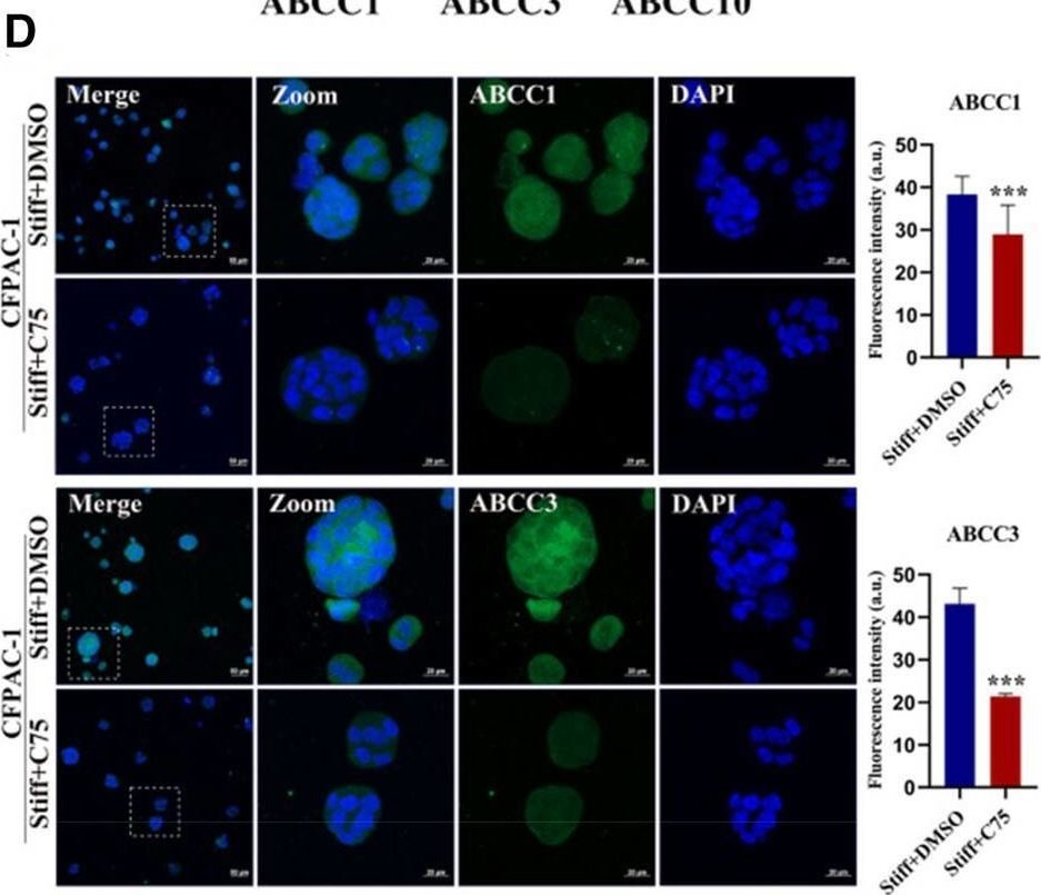 Fig.3.D showing Immunocytochemistry-immunofluorescence in a Homo sapiens (Human) sample from the publication: Matrix stiffness boosts PDAC chemoresistance via SCD1-dependent lipid metabolic reprogramming.