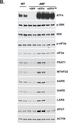 Fig.4.B showing Western Blotting in a Mus musculus (House mouse) sample from the publication: The mTORC1-mediated activation of ATF4 promotes protein and glutathione synthesis downstream of growth signals.