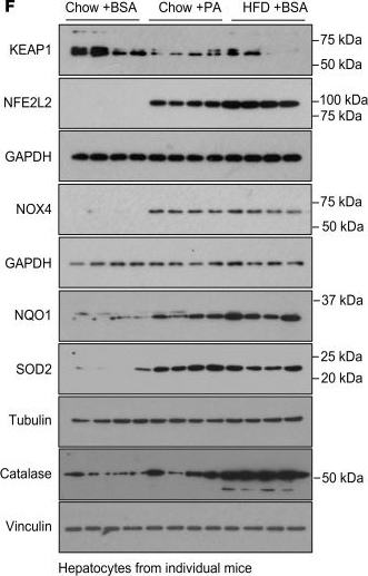Fig.2.F showing Western Blotting from the publication: Mitochondria- and NOX4-dependent antioxidant defense mitigates progression to nonalcoholic steatohepatitis in obesity.