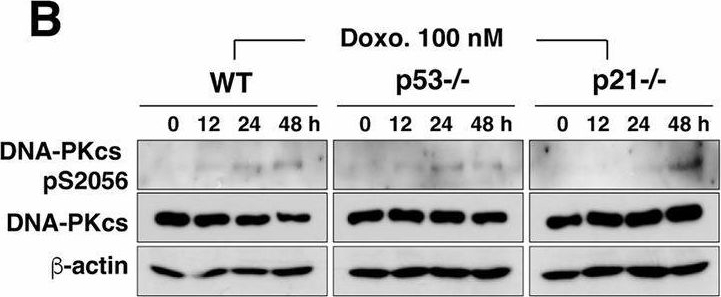 Fig.6.B showing Western Blotting in a Homo sapiens (Human) sample from the publication: Dual role of p21 in regulating apoptosis and mitotic integrity in response to doxorubicin in colon cancer cells.