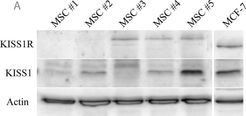 Fig.1.A showing Western Blotting from the publication: The KISS1 Receptor as an In Vivo Microenvironment Imaging Biomarker of Multiple Myeloma Bone Disease.