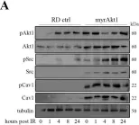 Fig.3.A showing Western Blotting in a Homo sapiens (Human) sample from the publication: Statin-Sensitive Akt1/Src/Caveolin-1 Signaling Enhances Oxidative Stress Resistance in Rhabdomyosarcoma.